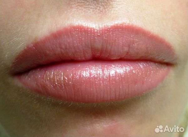 Средства после депиляции и Лазерная эпиляция - удаление