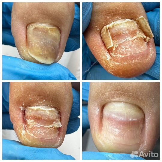 Услуги подолога