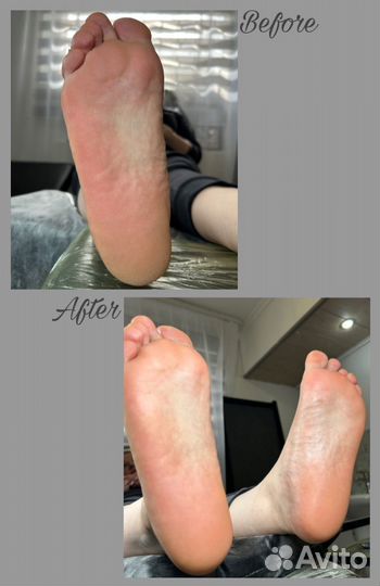 Smart-педикюр