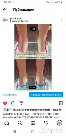 Индивидуальные ортопедические стельки