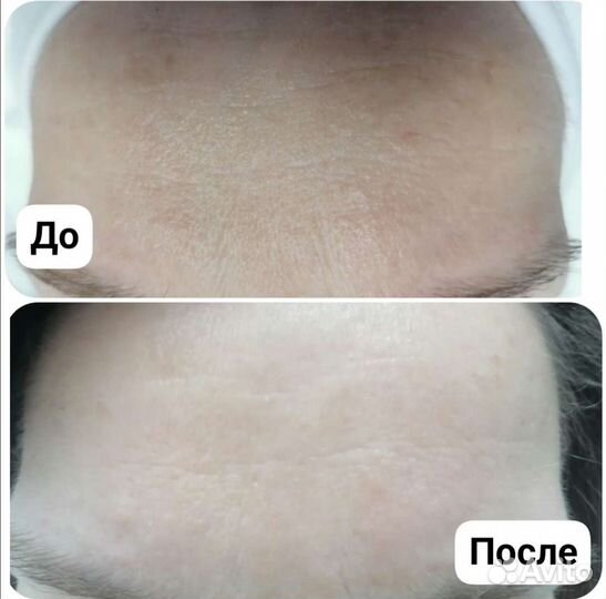 Услуги косметолога