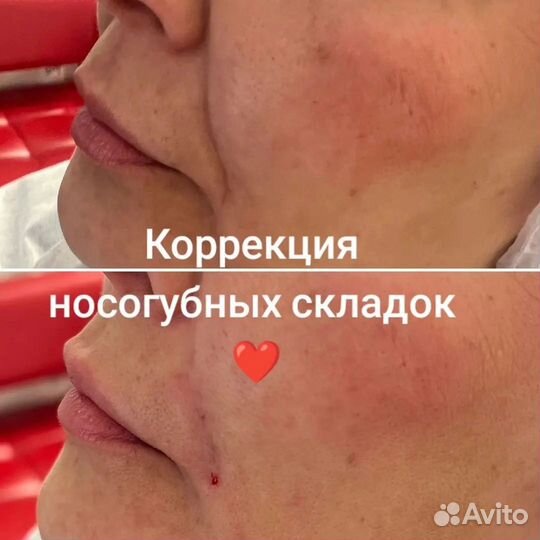 Услуги косметолога