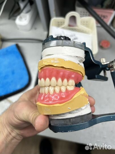 Зубные протезы