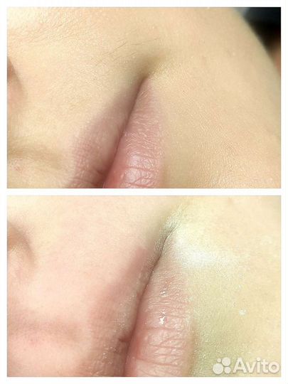 Шугаринг в Судаке