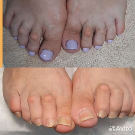Качественный педикюр