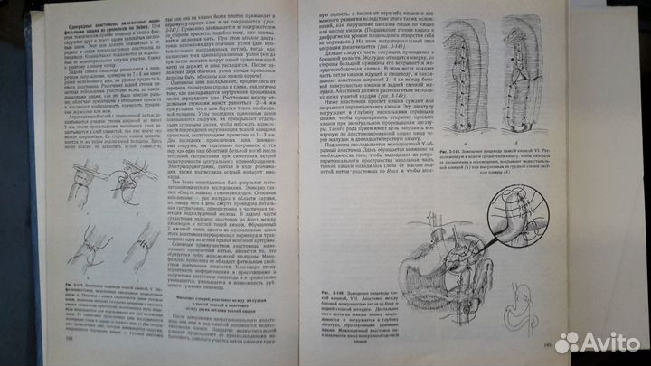 Оперативная хирургия проф. И. Литтманна