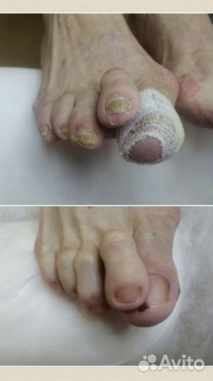 Подолог со стажем. Любые проблемы ног и рук