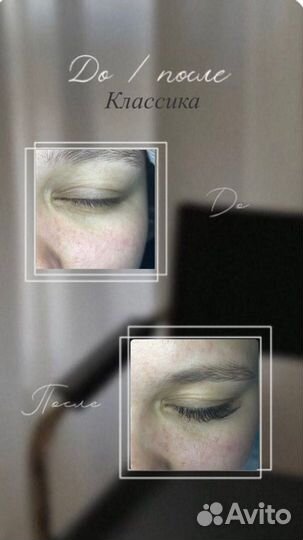 Наращивание ресниц