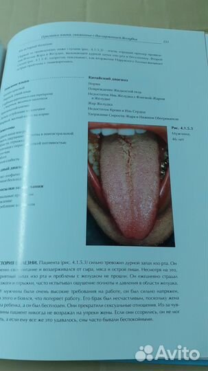 Атлас Китайской диагностики по языку