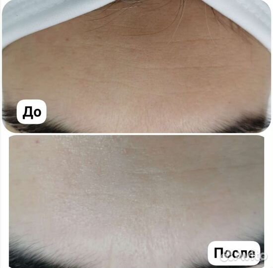 Услуги косметолога