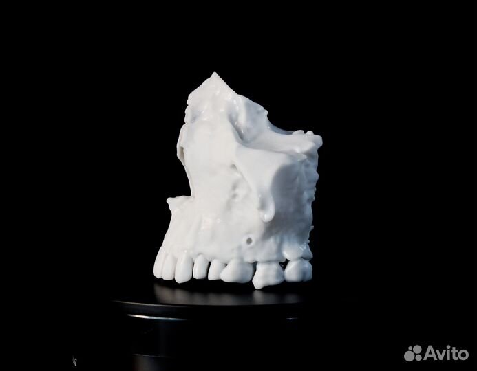 Анатомическая модель верхней челюсти