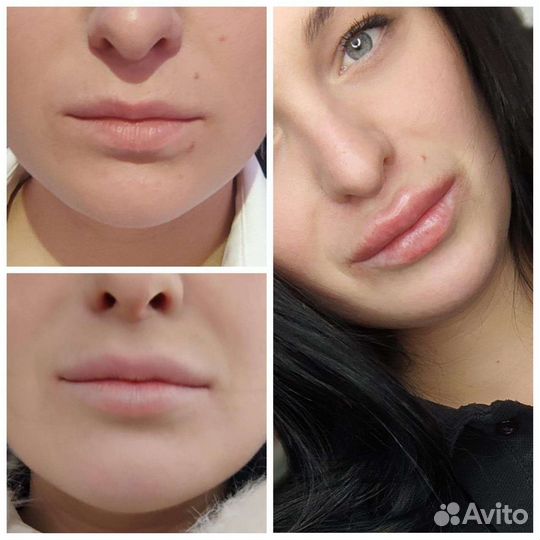 Услуги косметолога