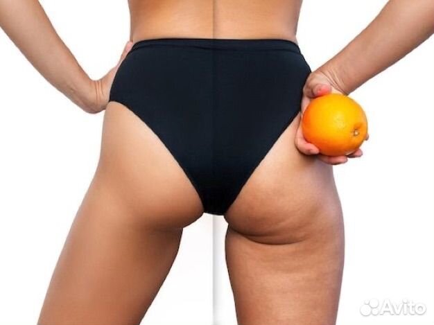 Массаж эндосфера+EMSculpt минус 10 см за курс