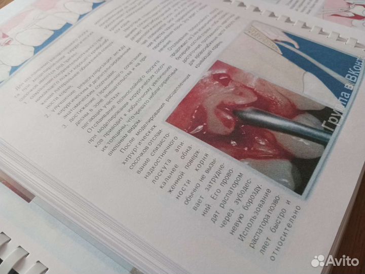 Пластическая хирургия мягких тканей