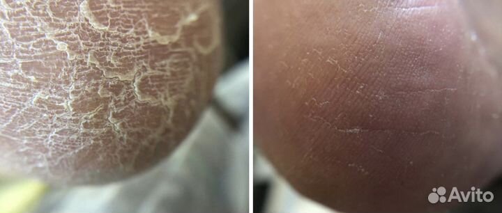 Услуги подолога