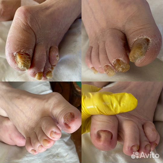 Педикюр подолог выезд на дом