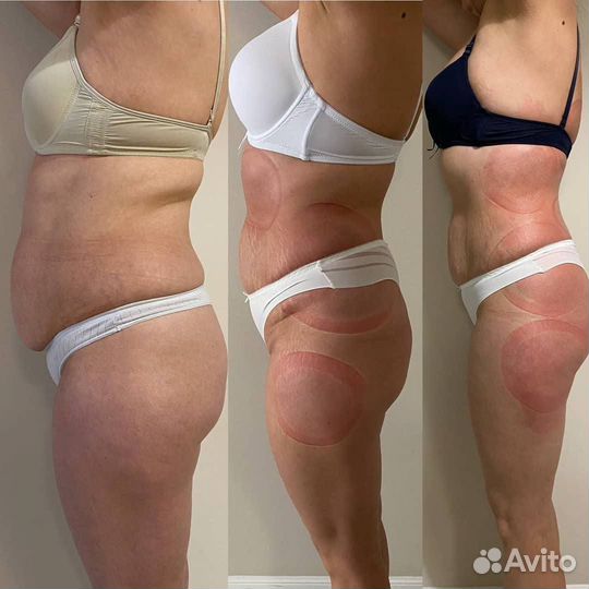 Ищем модель на коррекцию фигры