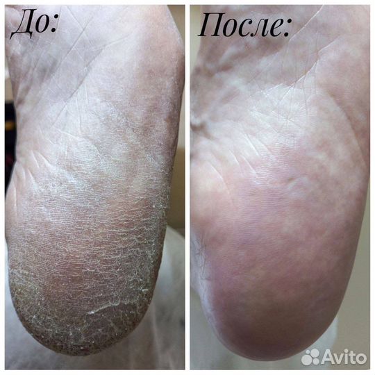 Маникюр, педикюр