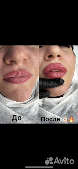 Косметология