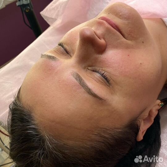 Перманентный макияж. Удаление