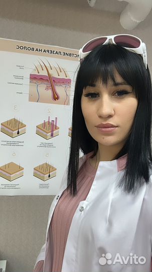 Лазерная эпиляция