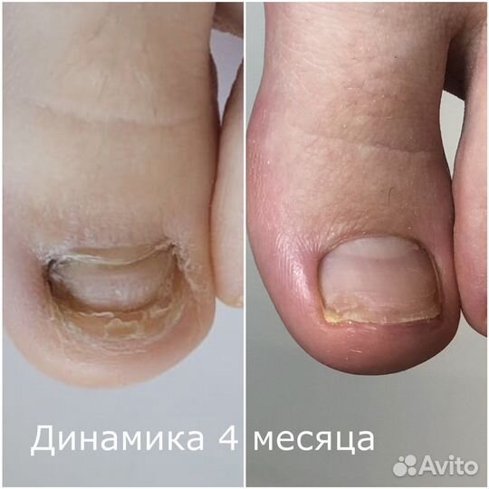 Педикюр подолог центр