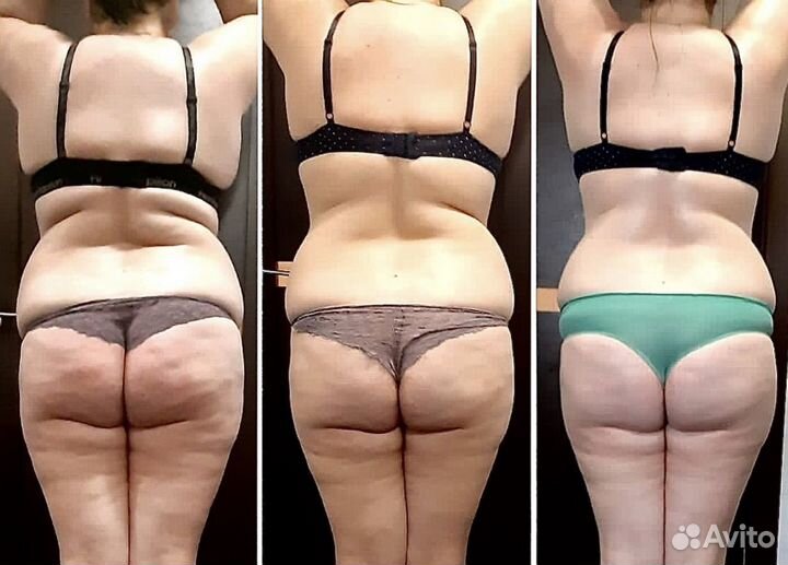 Аппаратный массаж