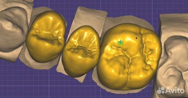 Курс по ExoCad, программа в подарок