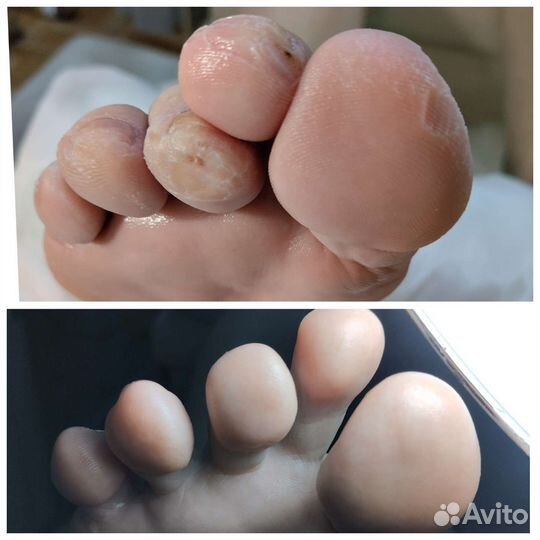 Педикюр/маникюр с выездом на дом любой сложности