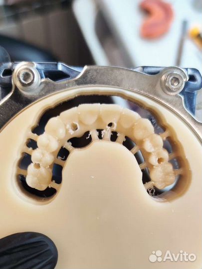 3d моделирование каркасов бюгельных протезов