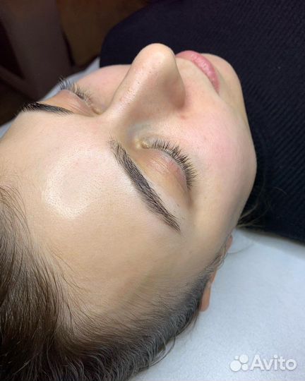 Механическая чистка лица