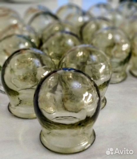 Банки медицинские СССР