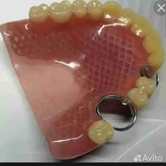 Ремонт и изготовление Съёмных зубных протезов