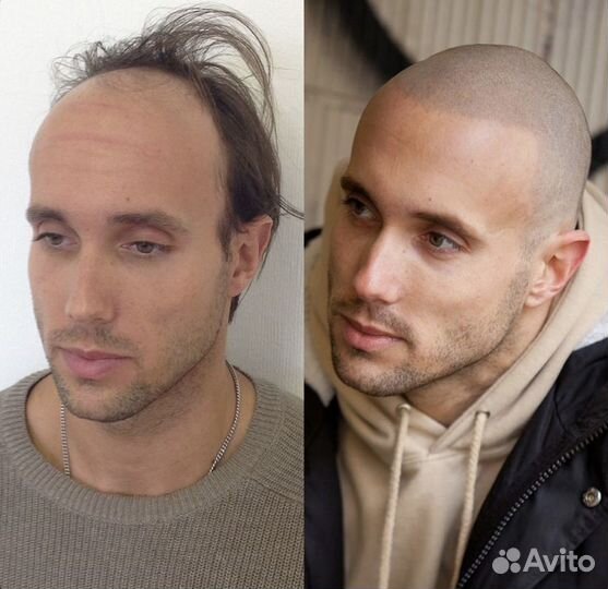 Перманентный макияж