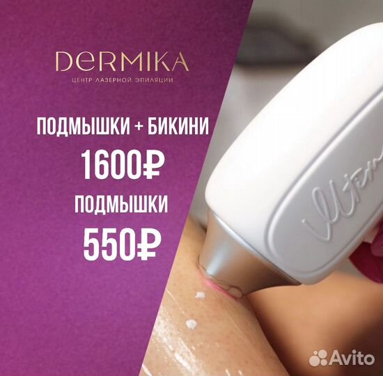 Лазерная эпиляция