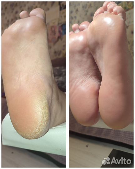 Маникюр педикюр на дому