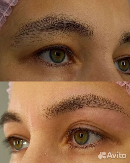 Шугаринг Полевской