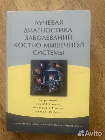 Лучевая диагностика заболеваний костной системы