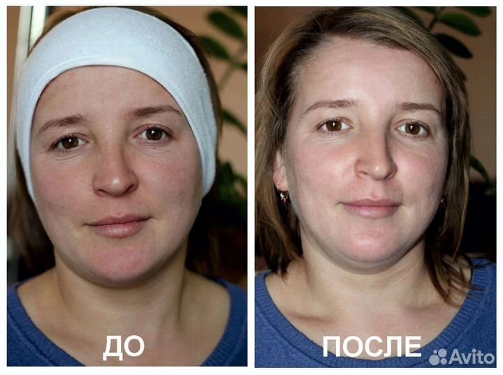 Массаж классический