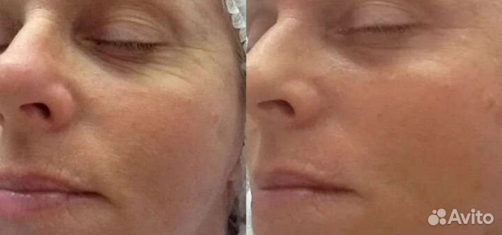 Услуги профессионального косметолога