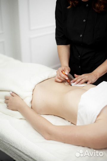 Бионити, коррекция фигуры, похудение, кетгут