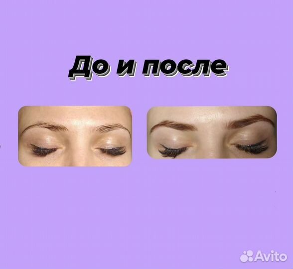Брови, ресницы