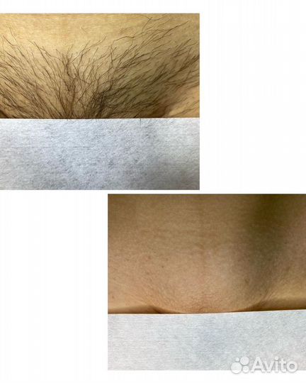 Мастер шугаринга и депиляции