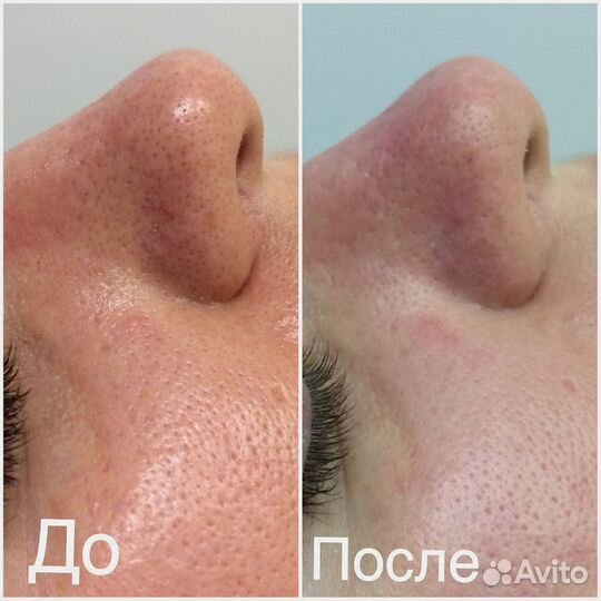 Косметологические услуги