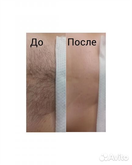 Депиляция воском