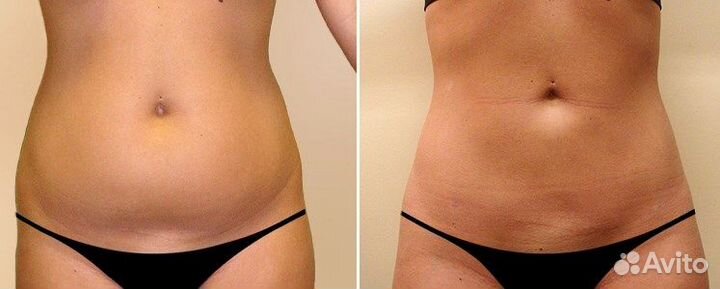 Модели на Кавитация Живота