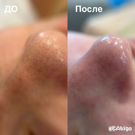 Косметолог эстетист