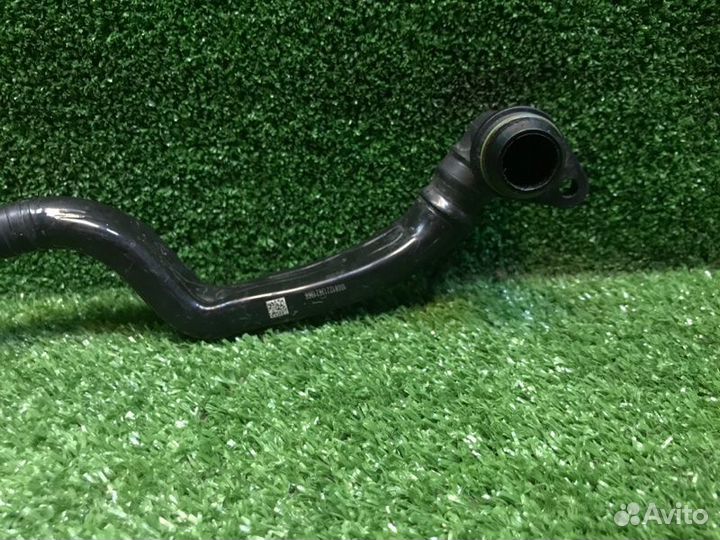 Трубка Mercedes Glk