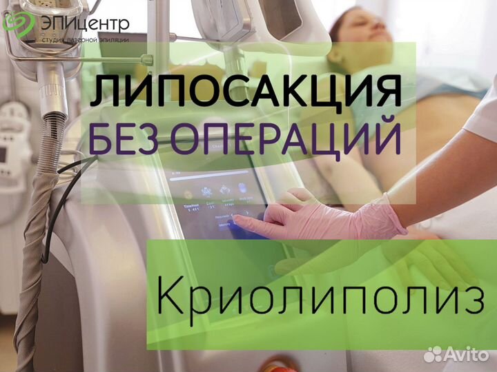 Криолиполиз, похудение