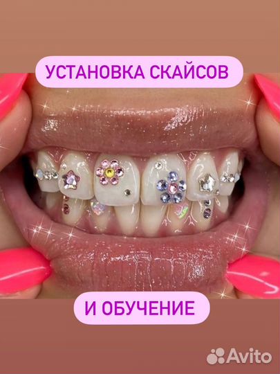 Скайсы и обучение установки скайсам